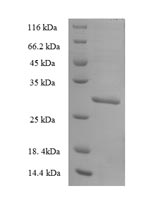 Human NXNL2 protein