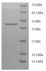 Human LARP1B protein