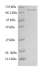 Human NET1 protein
