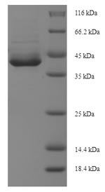 Human AEN protein
