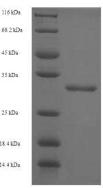 Human ST8SIA4 protein