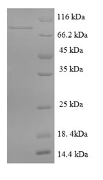 Human DENND1A protein