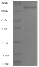 Human GALNT14 protein