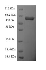Human SCARB1 protein