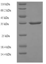 Human ALKBH3 protein