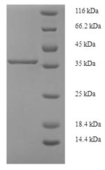 Human PIGX protein