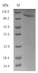 Human HSPBAP1 protein