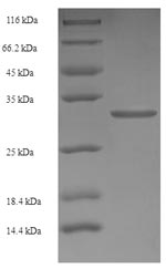 Human RARRES2 protein