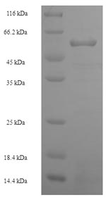 Human MTR protein