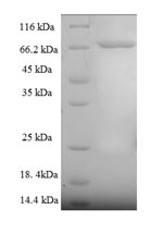 Human CPEB1 protein