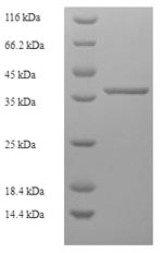 Human MLXIP protein