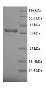 Human DUSP26 protein