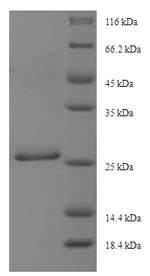 Human DYNLRB1 protein