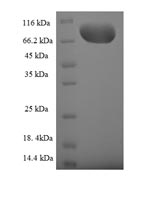 Human GNL3L protein