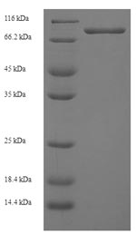 Human GDAP2 protein