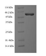 Human RMND5A protein