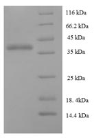 Human DGCR6L protein