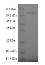 Human RABGEF1 protein