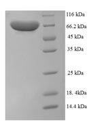 Human PADI1 protein