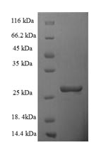 Human TIMM10B protein