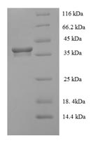 Human HEBP2 protein