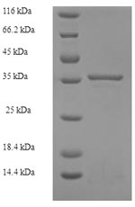 Human MRPL11 protein