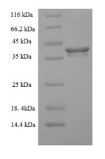 Human EMC9 protein