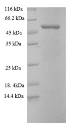 Human ADAM15 protein