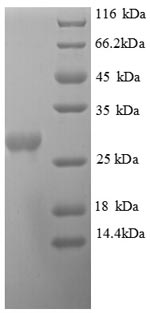 E.coli pyrF HP_0005 protein