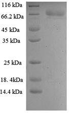 E.coli poly protein