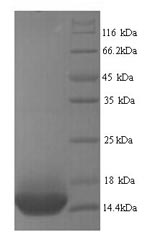 Human beta 1 Adrenergic Receptor protein