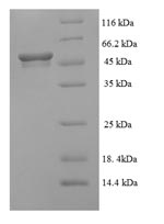 Human ALDH5A1 protein