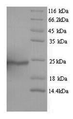 Aquaporin 4 Proteins