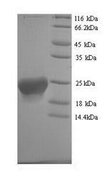 Human ASAH2B protein