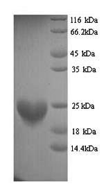 Mouse Cenpa protein