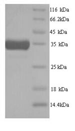 Mouse Hmox1 protein