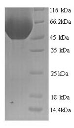 Rat Minpp1 protein