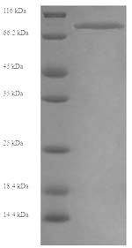 Human MYH6 protein