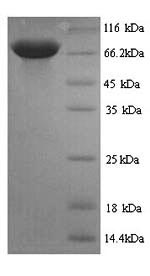 Rat Pklr protein