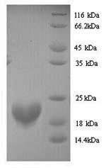 Human RBM3 protein