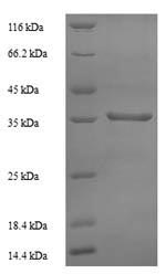 Human RPLP0 protein