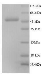 Human TUFM protein