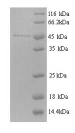 E. coli nrdB protein