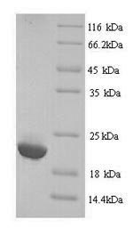 Human IGLL5 protein