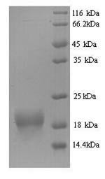 Mouse Fhit protein