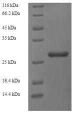 Rat Nqo2 protein