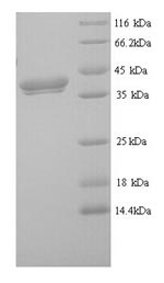 Mouse Fam132b protein