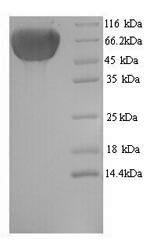 Human KRT77 protein