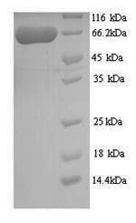 Human PEO1 protein