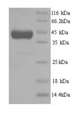 Human MTR protein